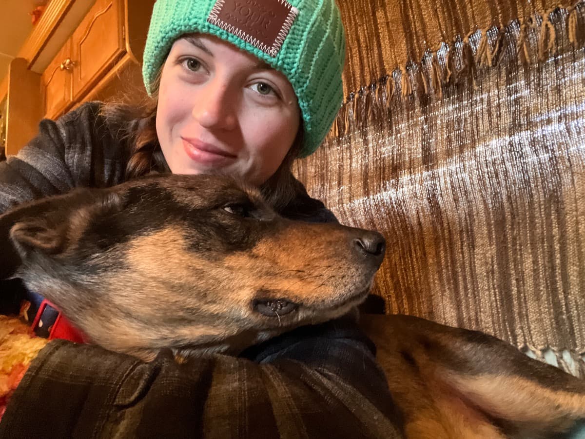 PlaquePsoriasisTreatment