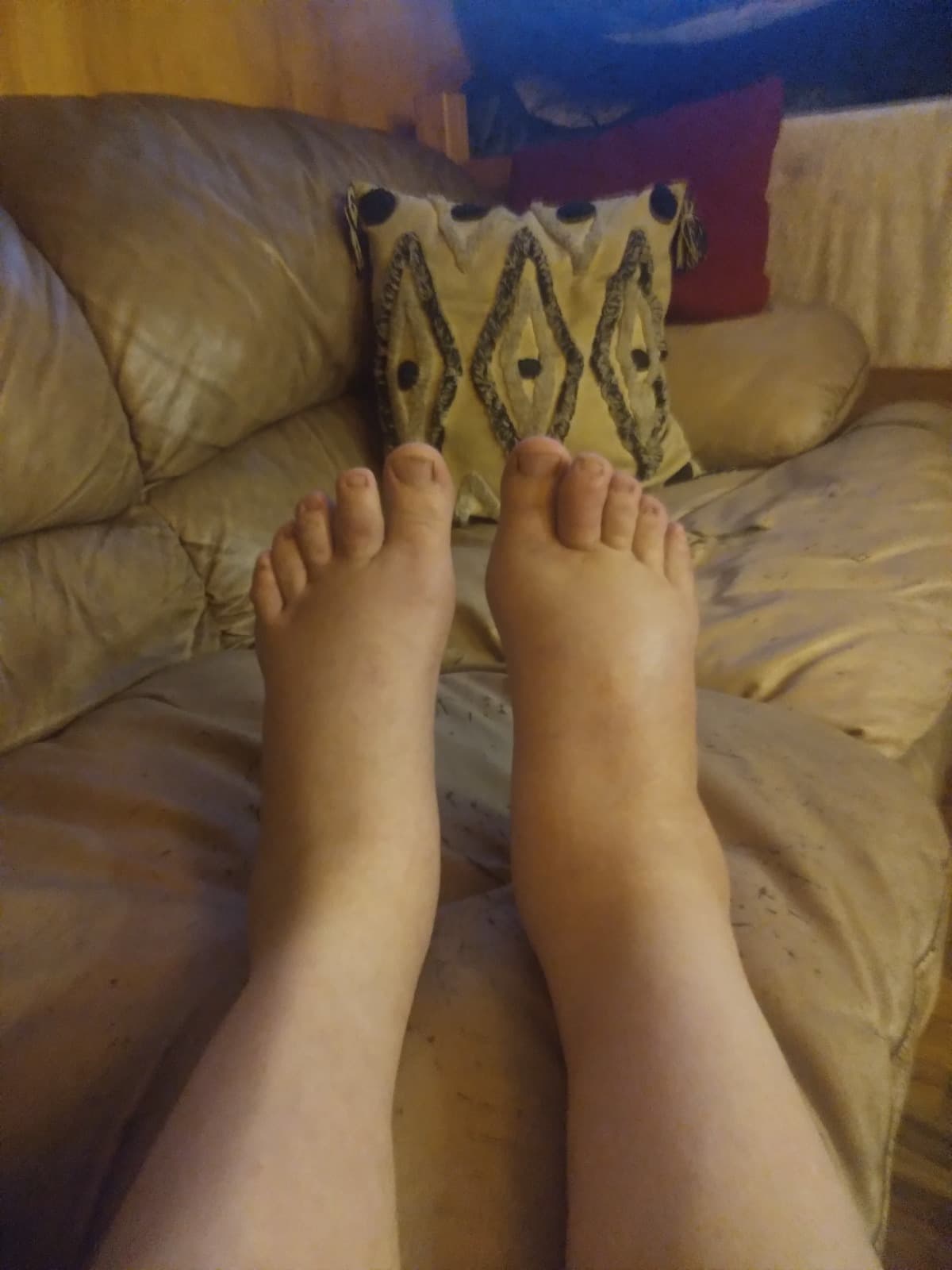 GoutAndPolyarthritis