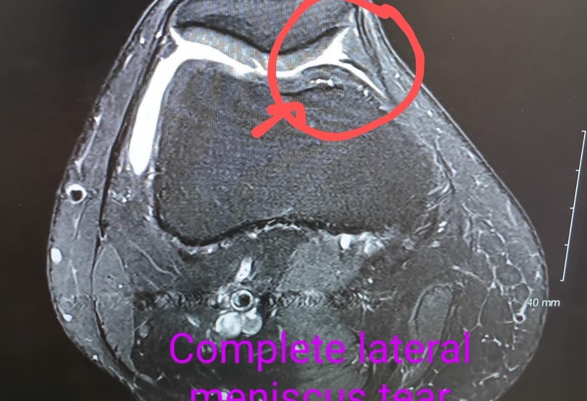 MOMOf2NeedsSurgeryPleaseHelp