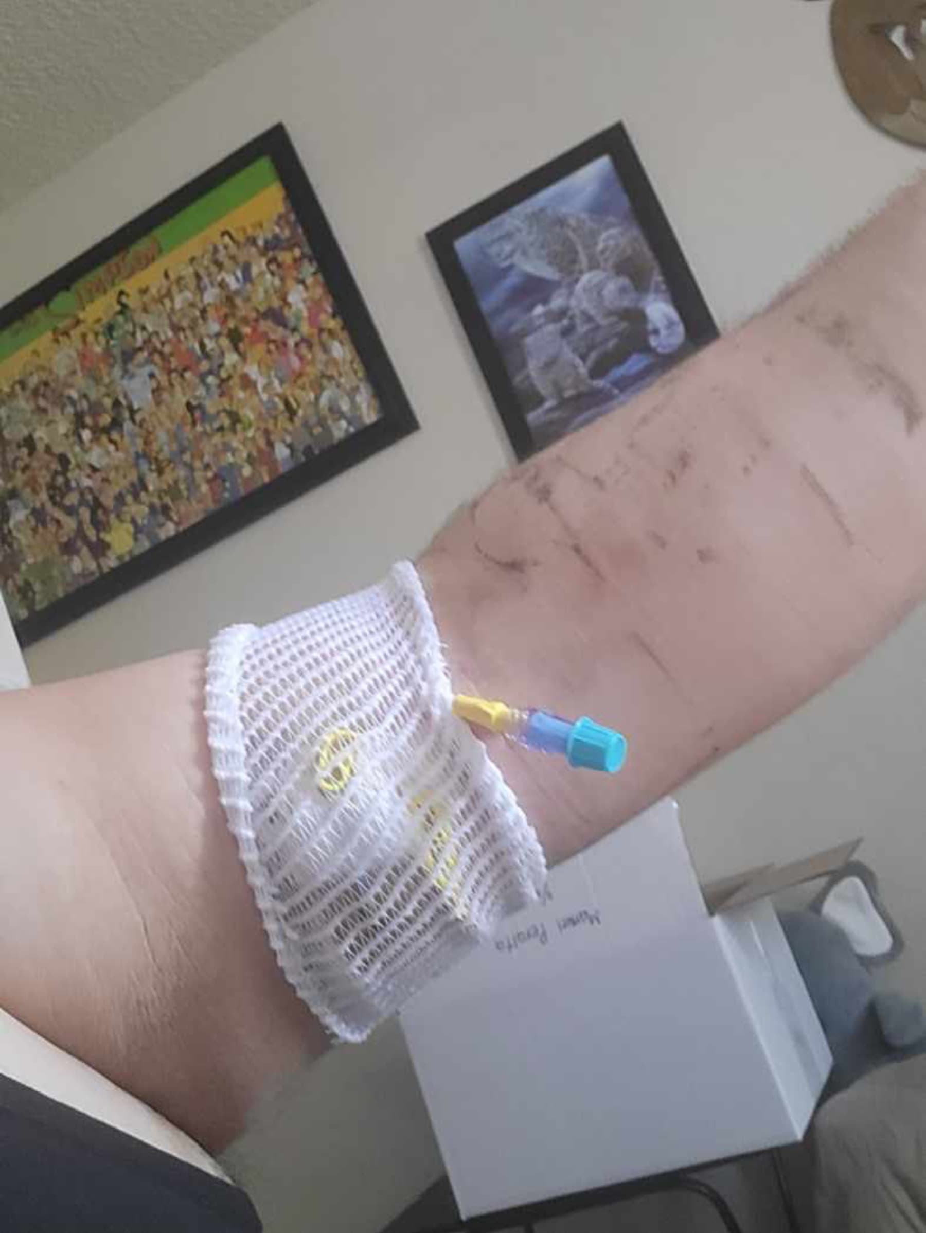 SuddenIllness