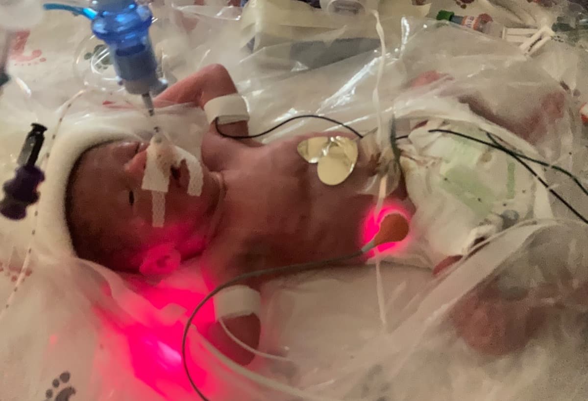 NICUBaby27Weeks