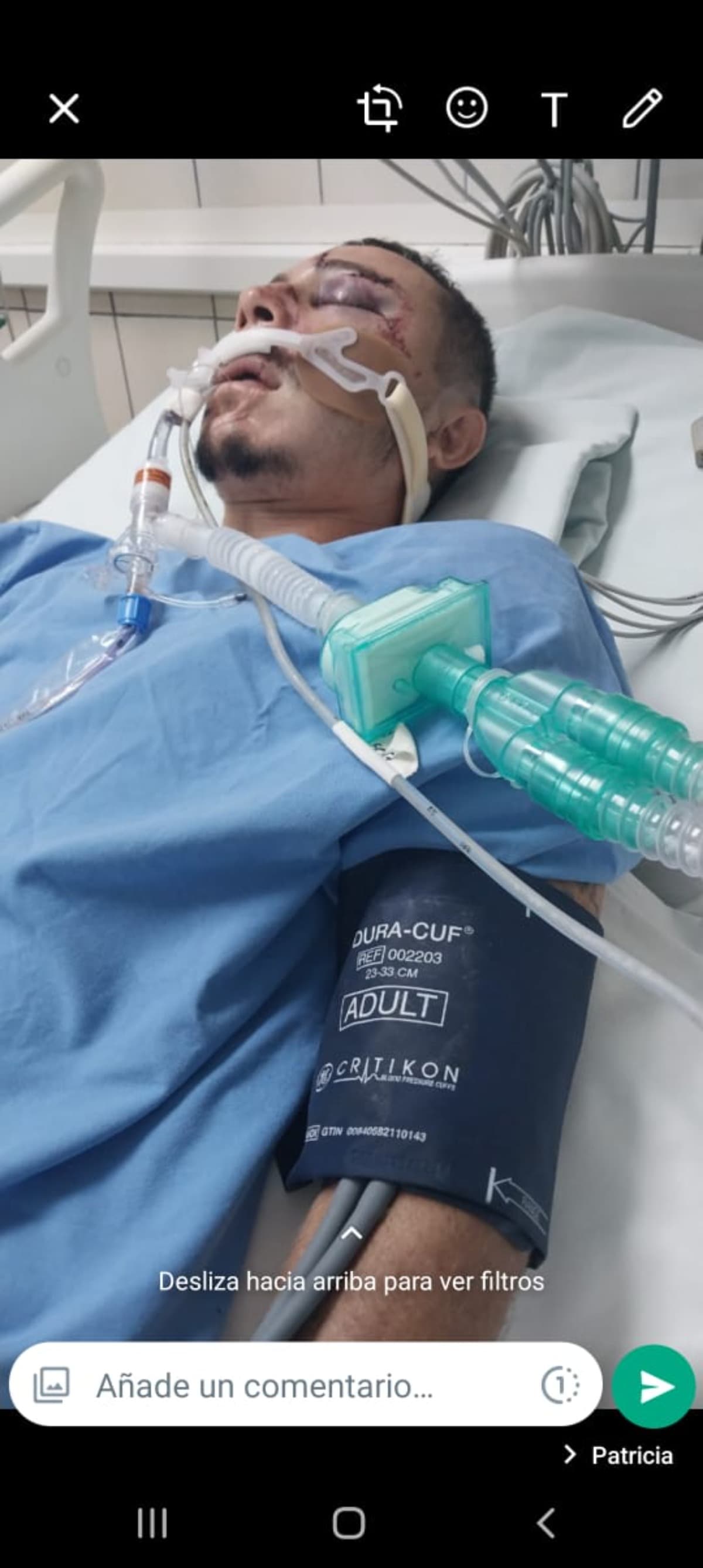 SevereMotorcycleAccident