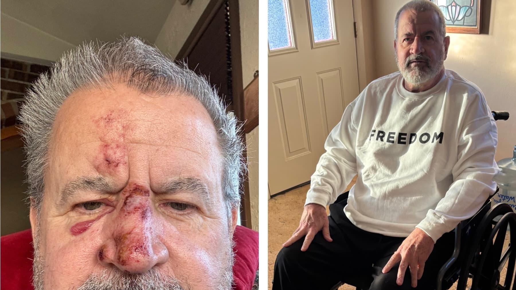 HelpSteveGetBackOnHisFeet