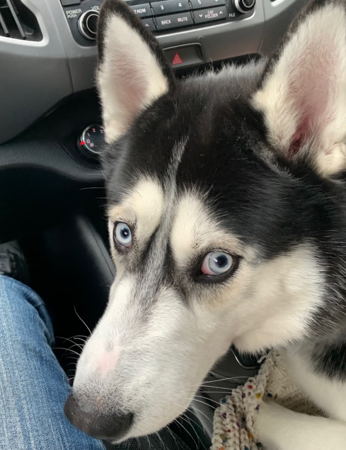 HusbandPassedAway70thDayIcu