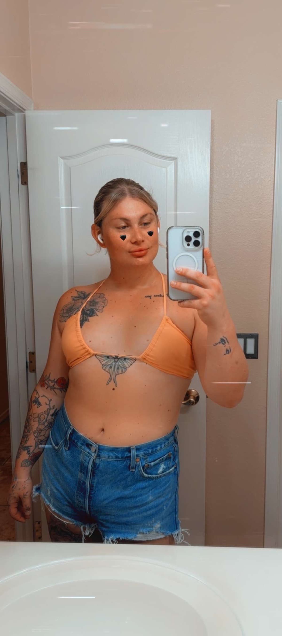 EleanorsBreastAugmentation