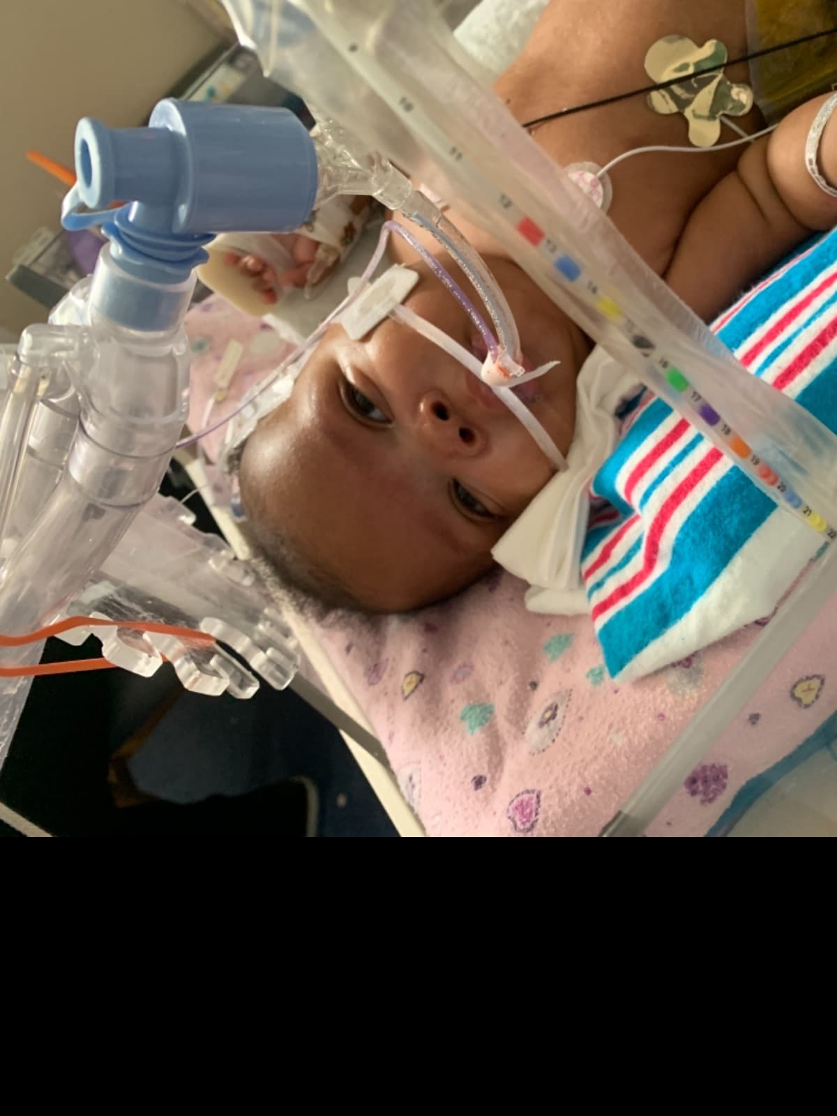 GracelynsHeartSurgery