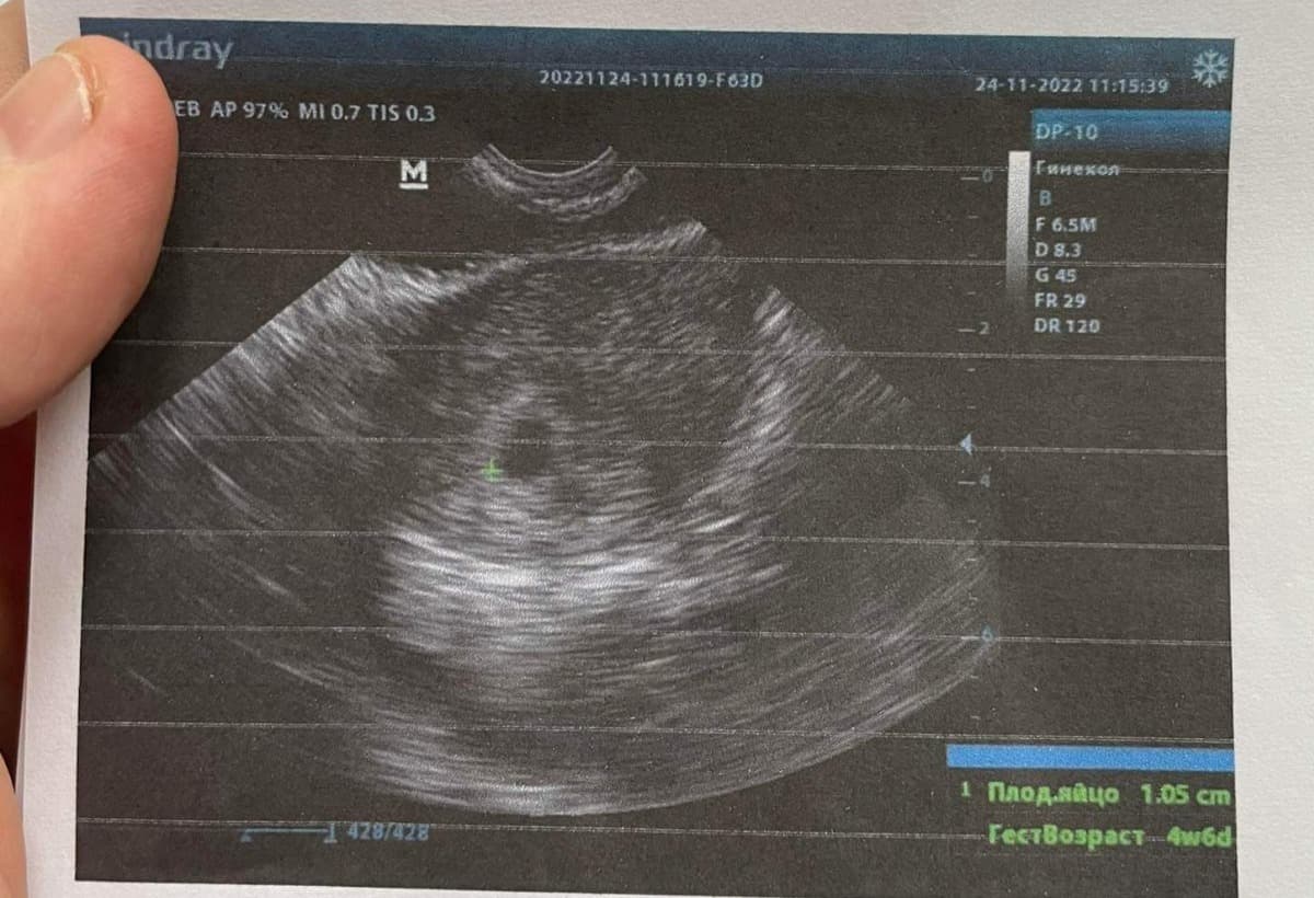 UkraineFriendNeedsGenerator