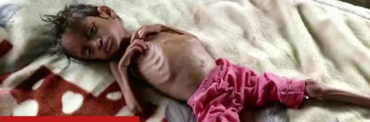 SaveStarvingChildren