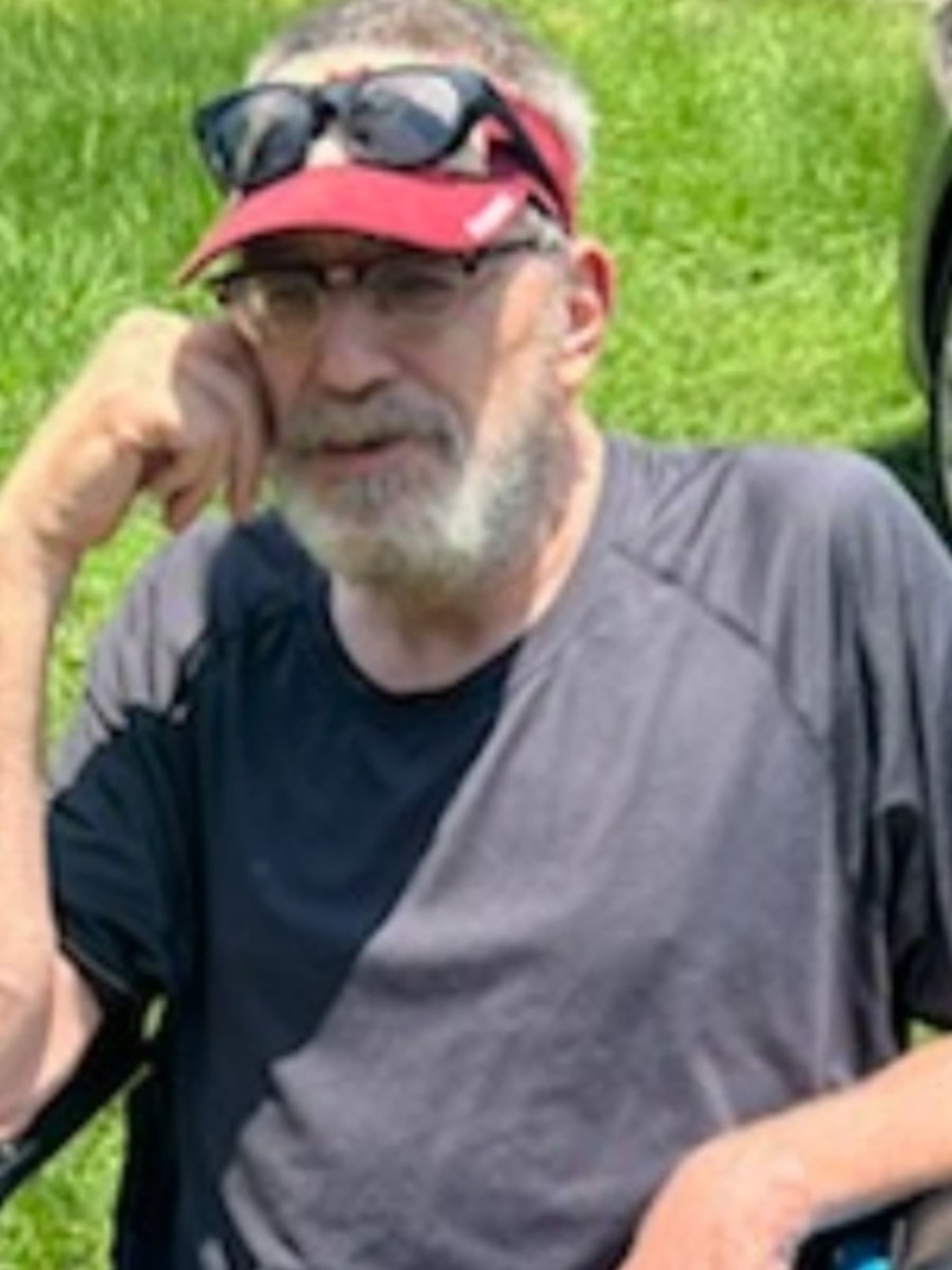 AmputeeLivingExpenses