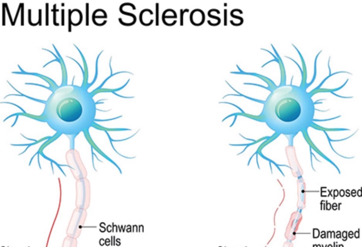 MakeAnMSJourneyLessStressful