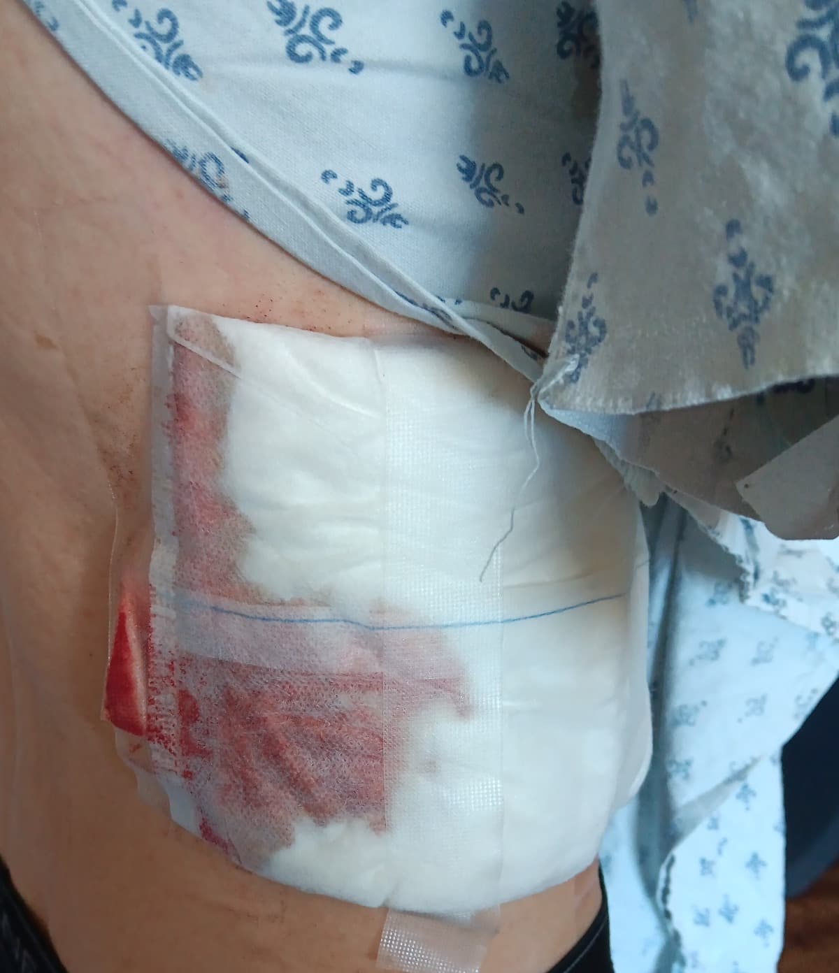SupportDuringRecovery