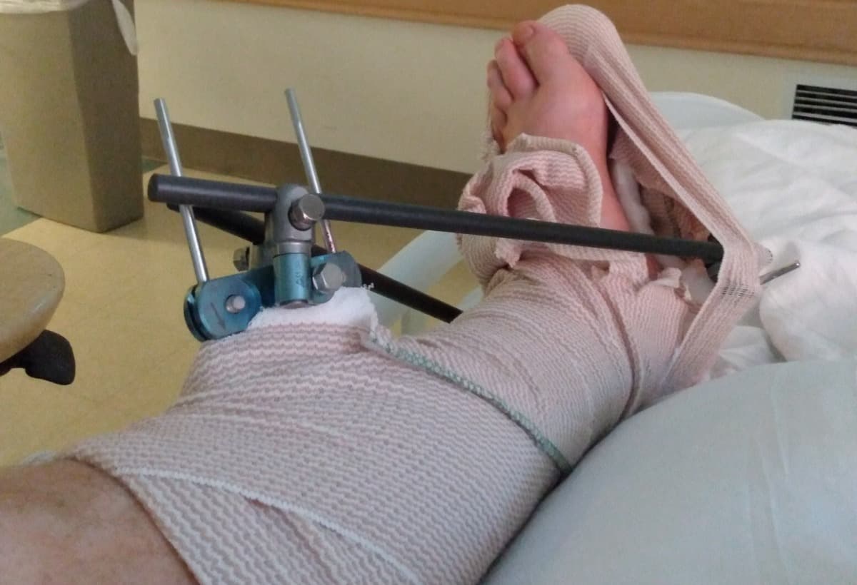 VehicleAccidentFundMitch