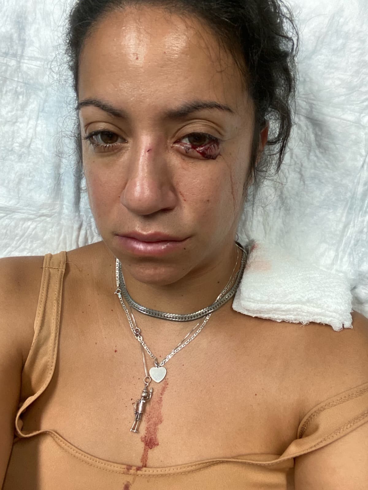 DogAttacksAlyssa