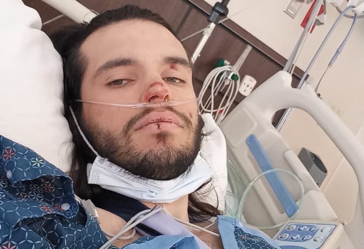 J1sCarCrashInColorado