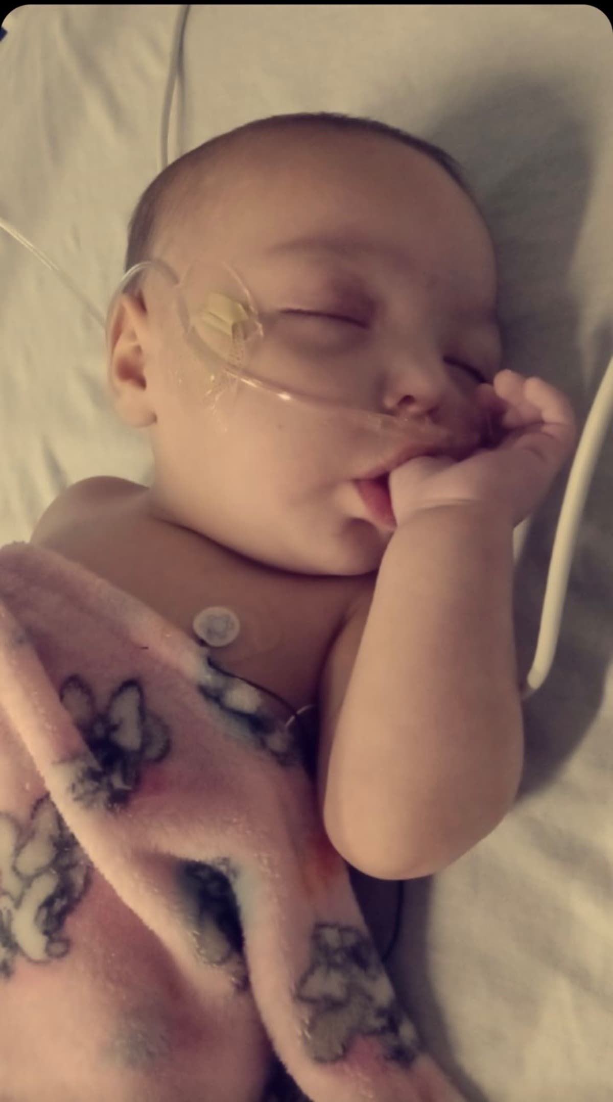 BabyHasCysticFibrosis