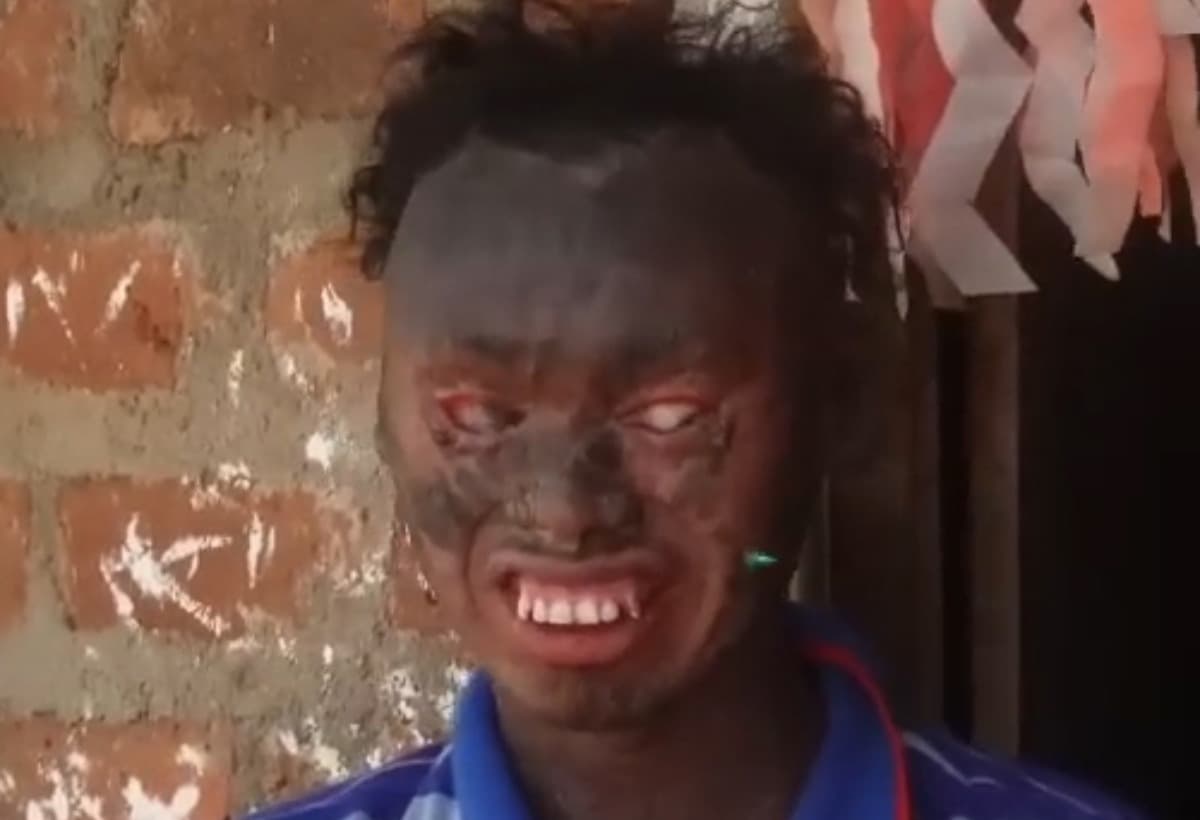 FundOurProtectiveCream