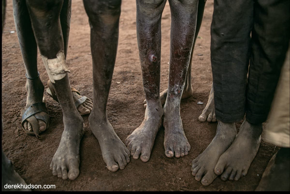 LostBoyFromSudan