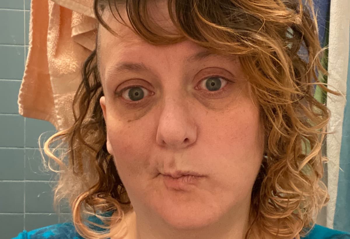 HelpMePayForMyLupusMeds