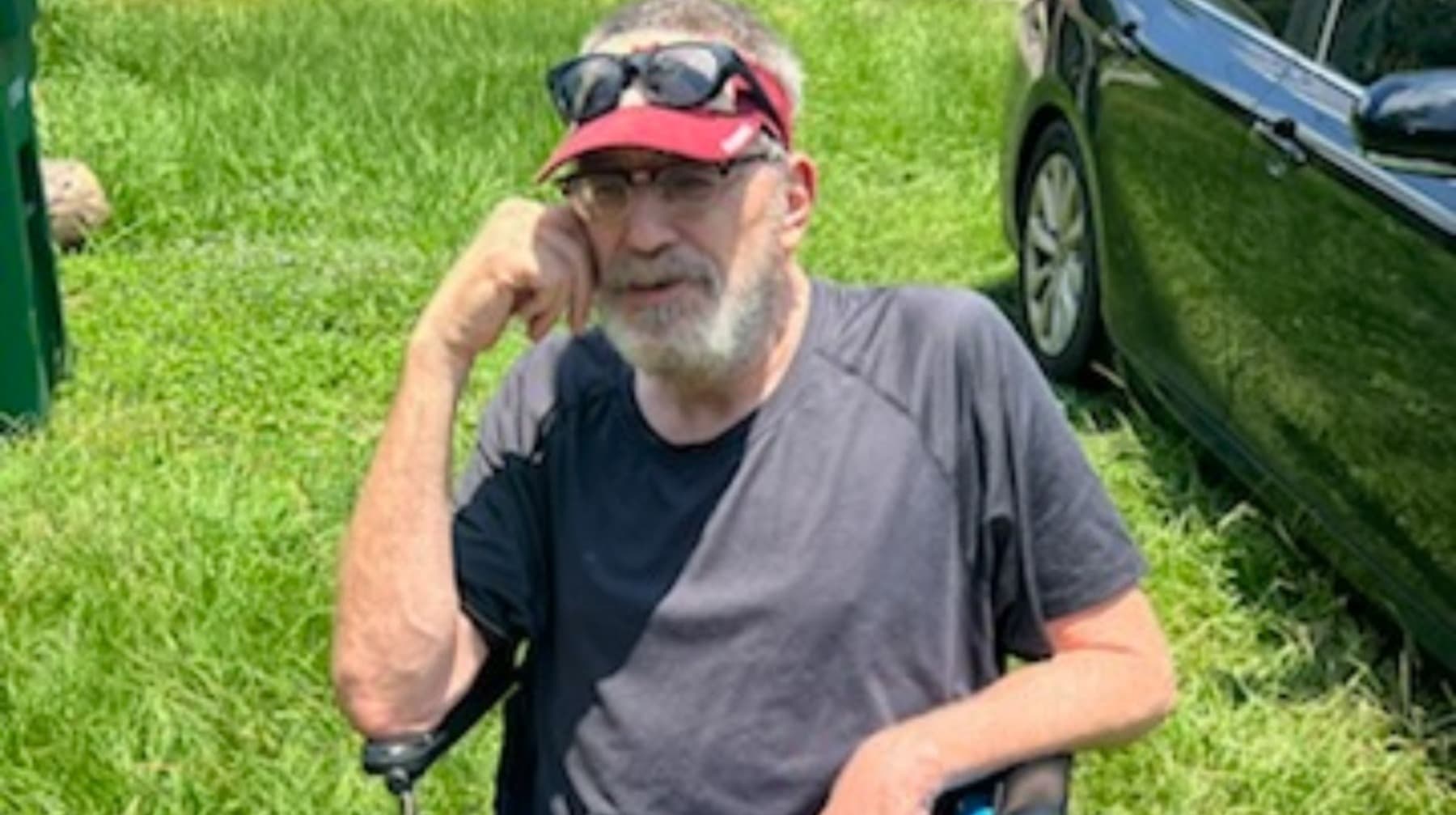 AmputeeLivingExpenses