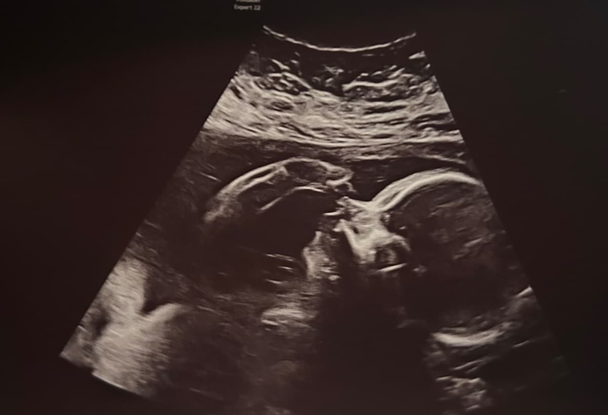 SupportForUnpaidLeave