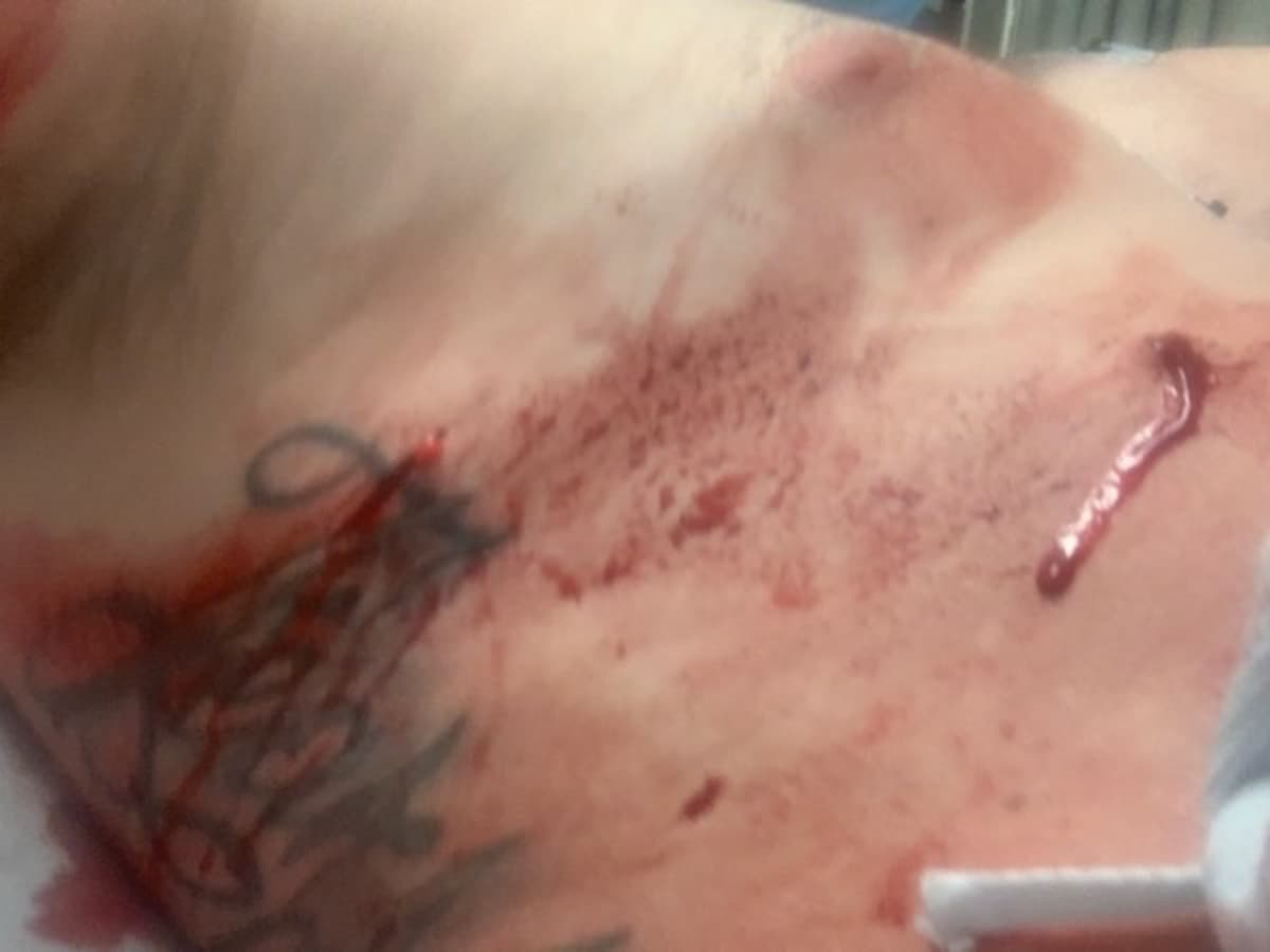 BillsFromBeingStabbed