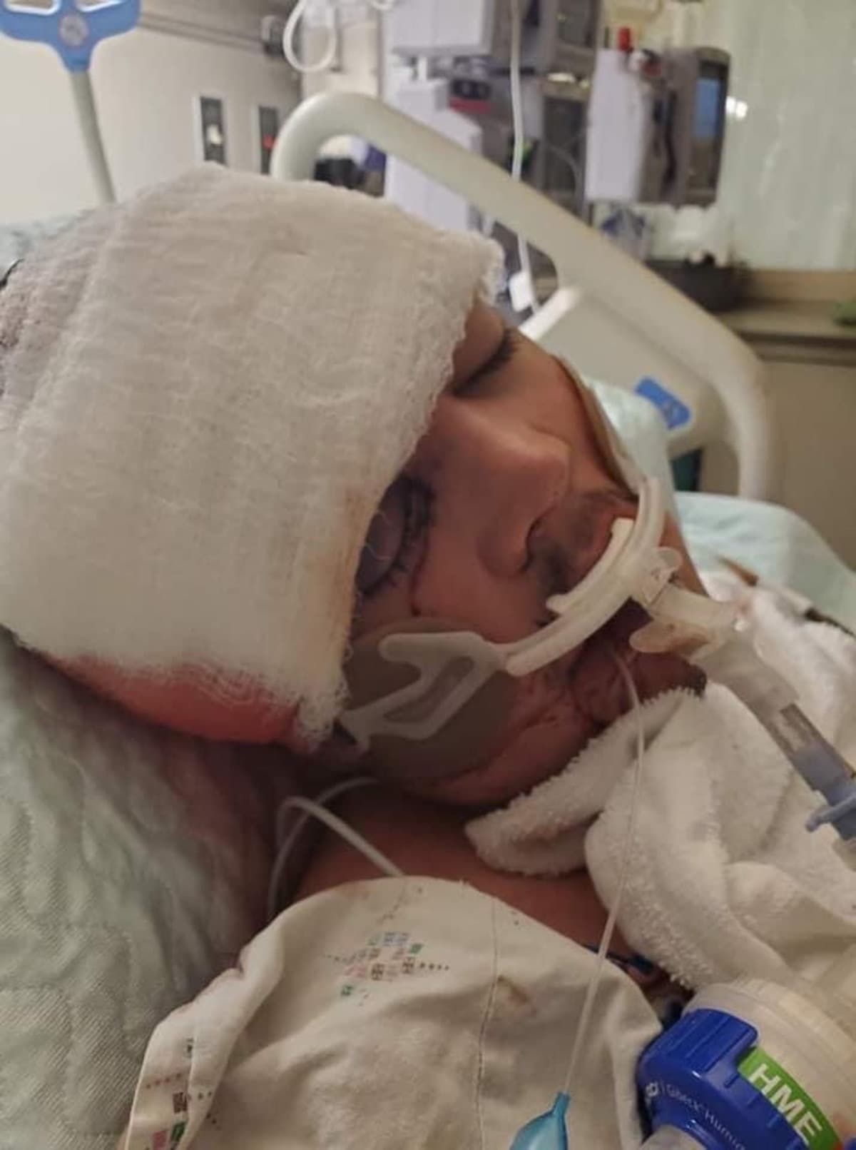 JoshuasJawSurgeryDuncan