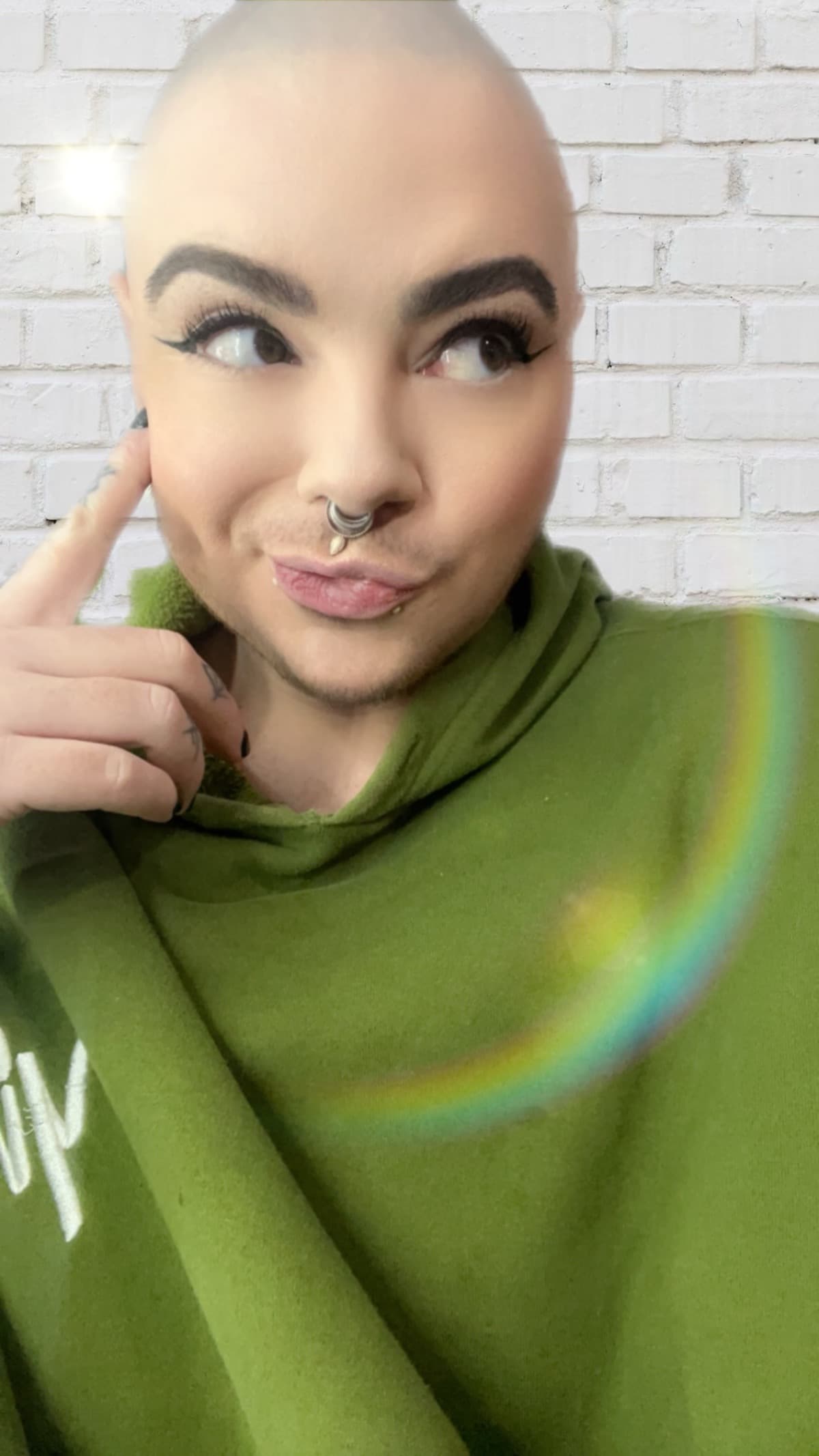 AshTopSurgery