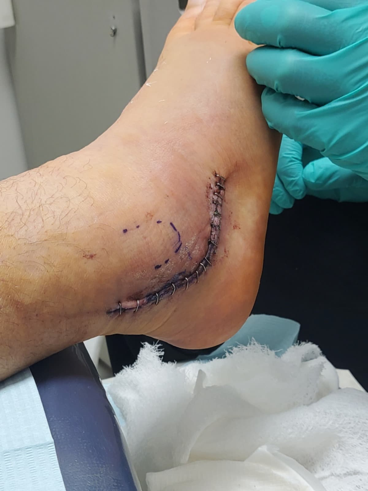 HelpFamilyToGetThruASurgery