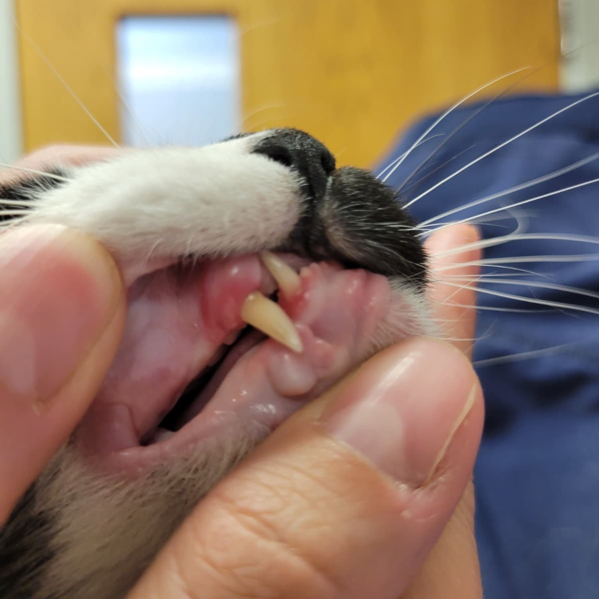 TeethRemovalProcedure