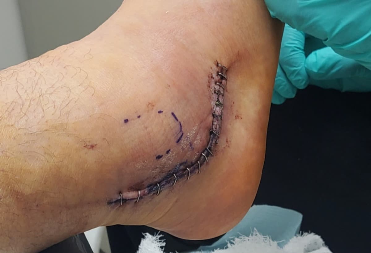 HelpFamilyToGetThruASurgery