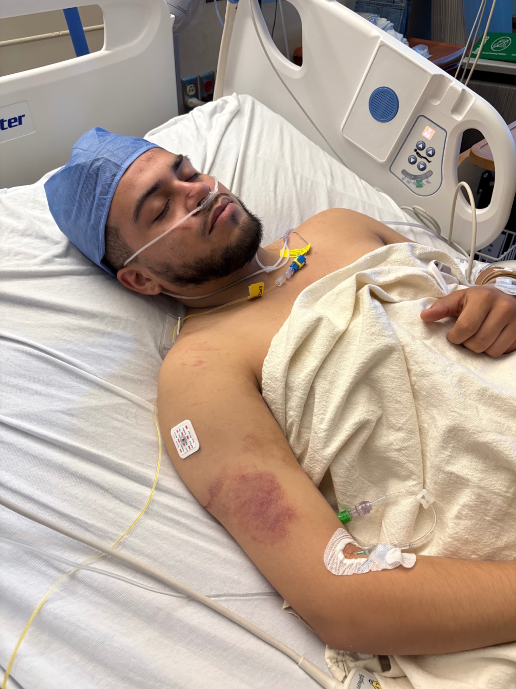 SupportDiegoOnHisRecovery