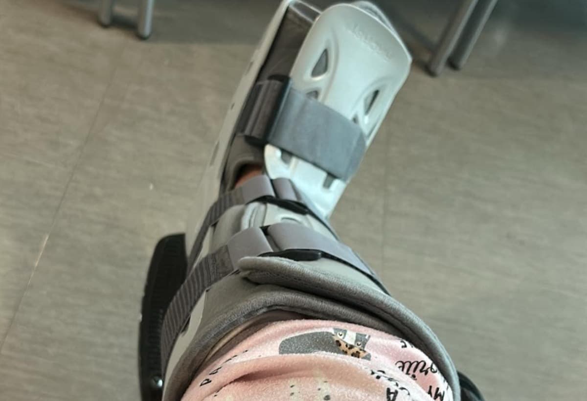 IRecentlyBrokeMyAnkle