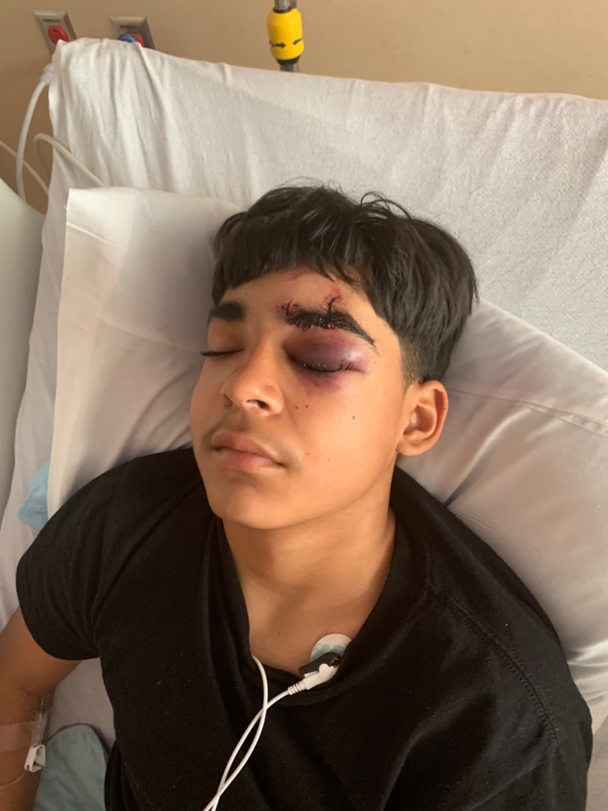 13YearOldBoyWasHitByACar