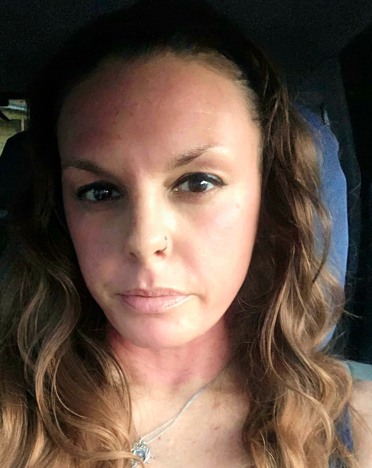 SurgeryRuinedMeAndINeedHelp