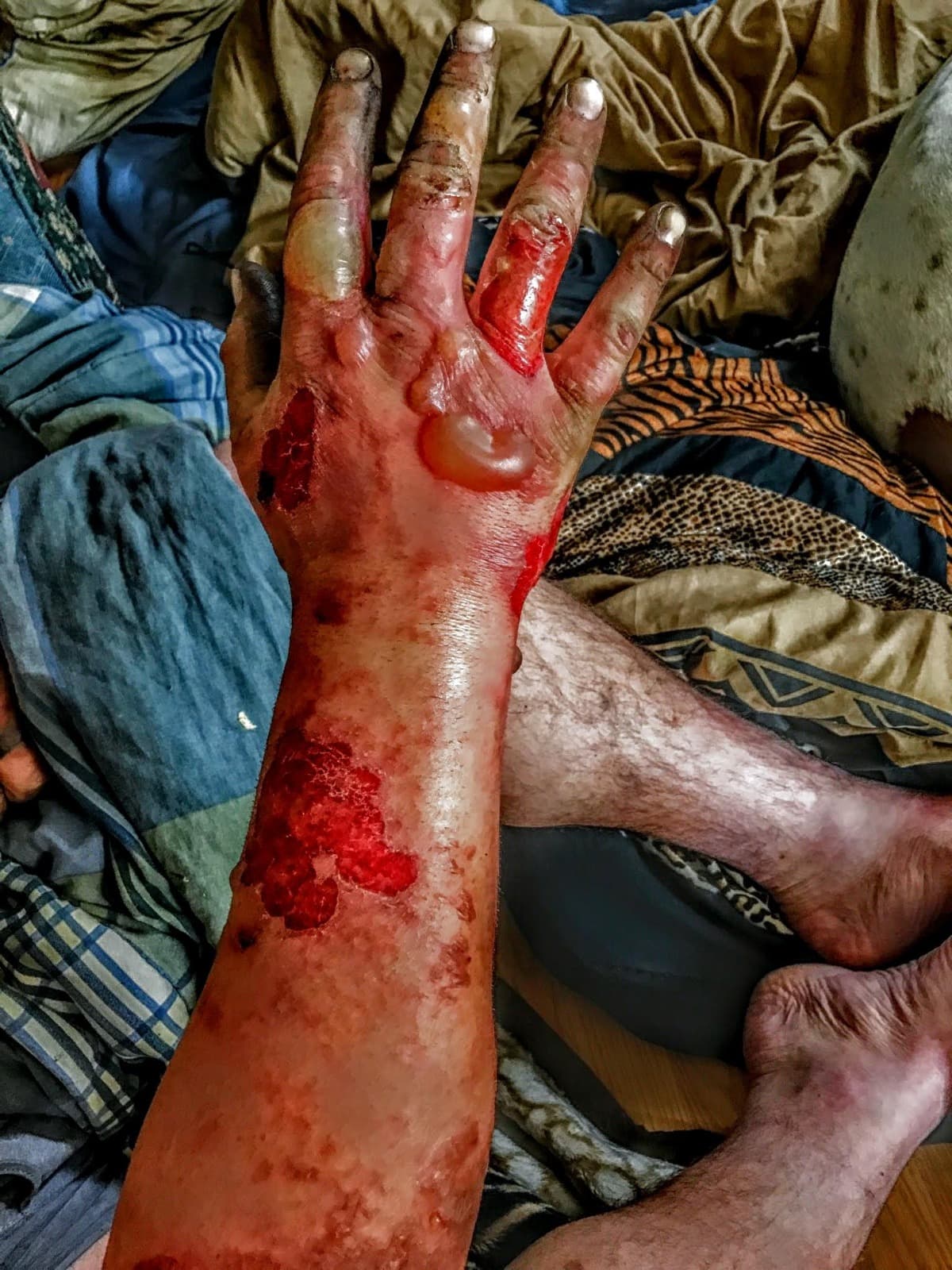 WildfireFamilySupport