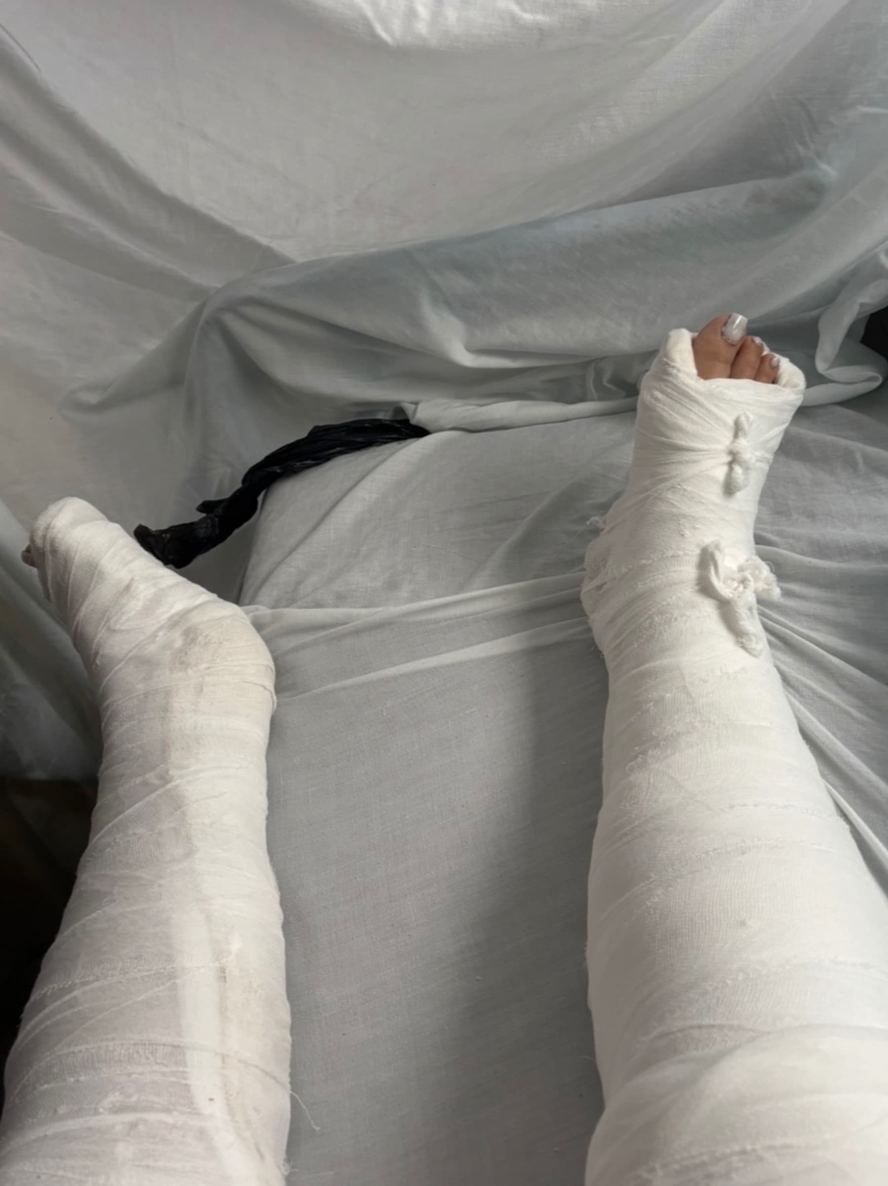 HelpMeRecoverFromAccident