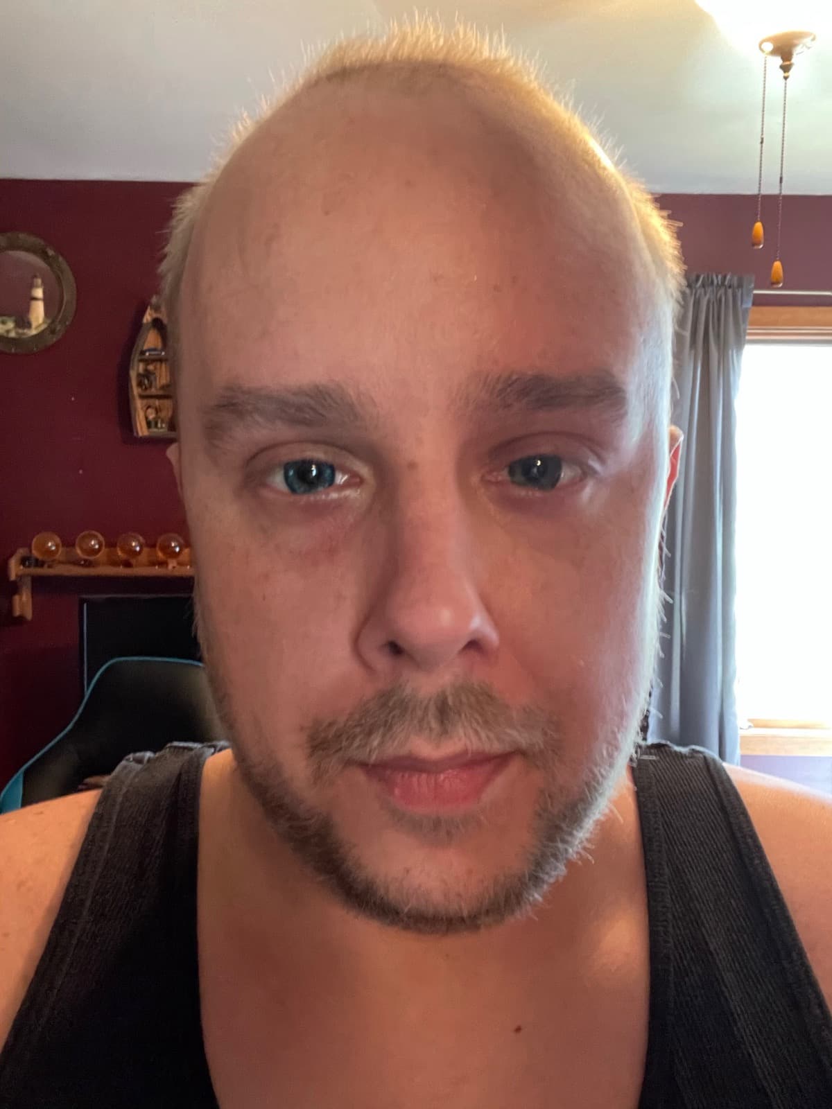 SarcomaCancerPatient