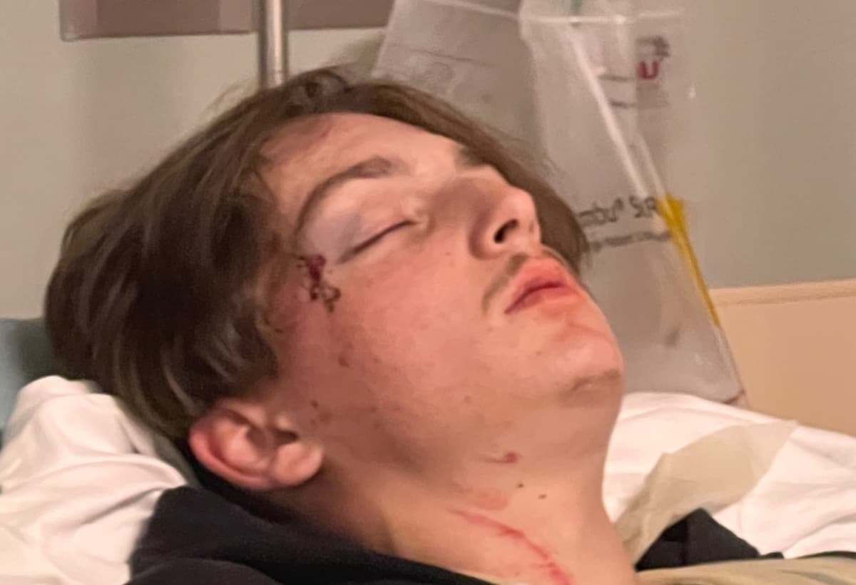 HelpCameronFightEpilepsy