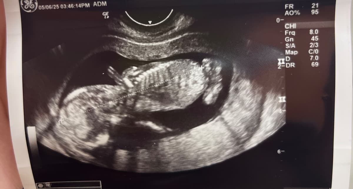 TryingToGiveMyBabyASafeStart