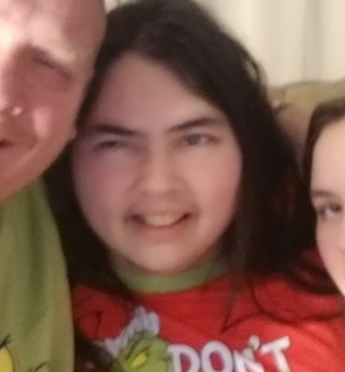 KidneyTransplantForCher