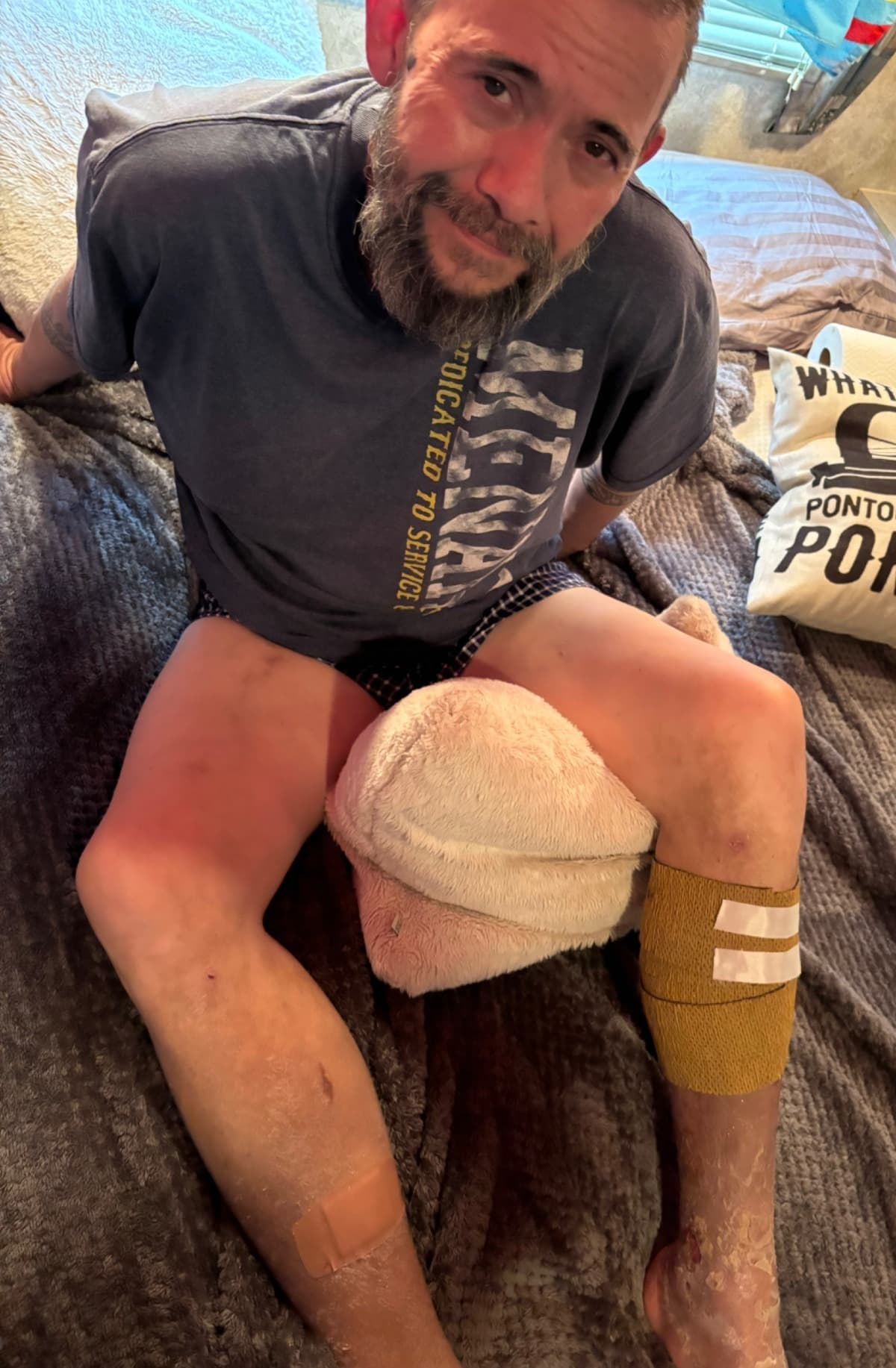 ContinualLegInjuries