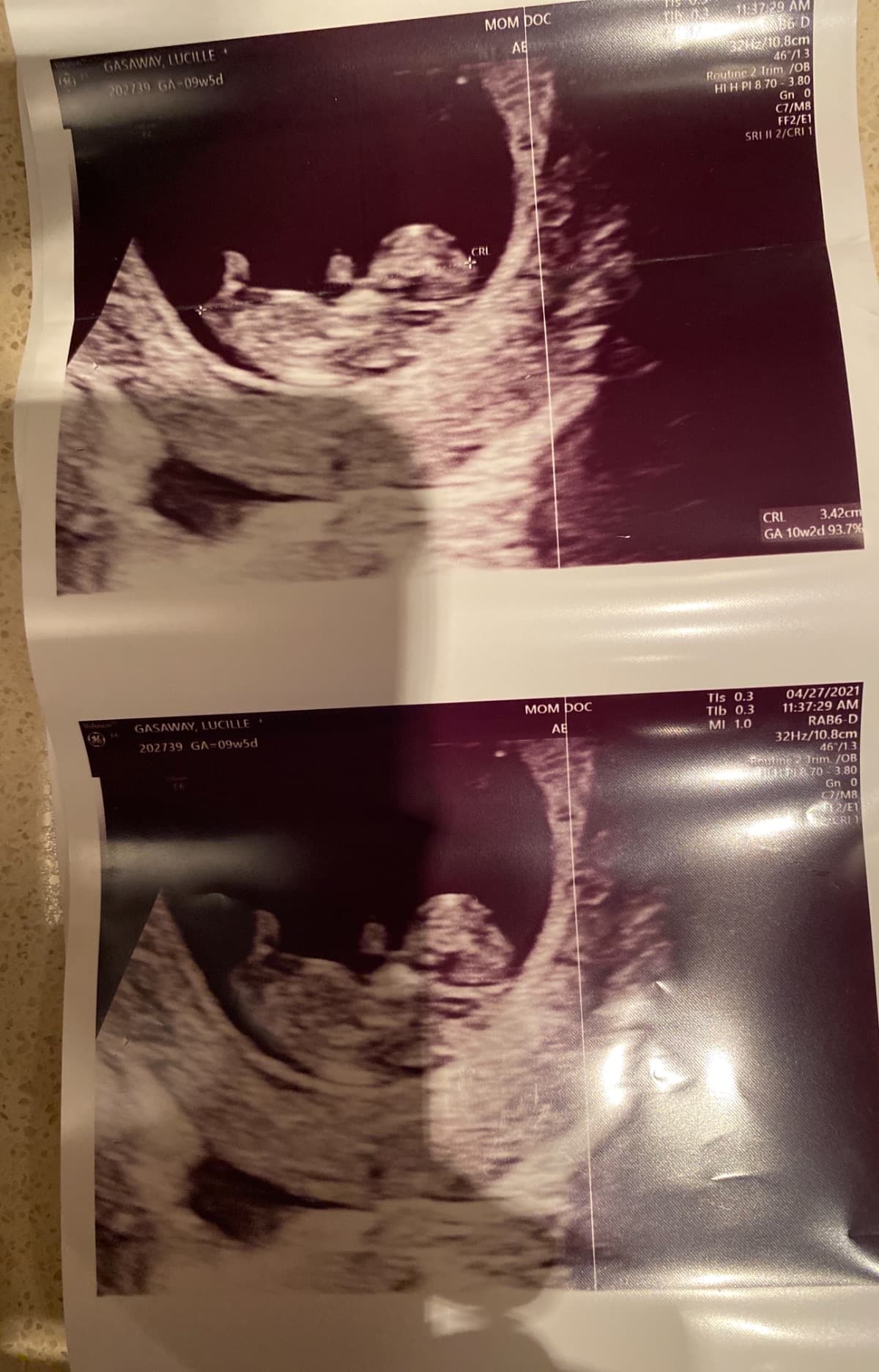 BabiesBirth