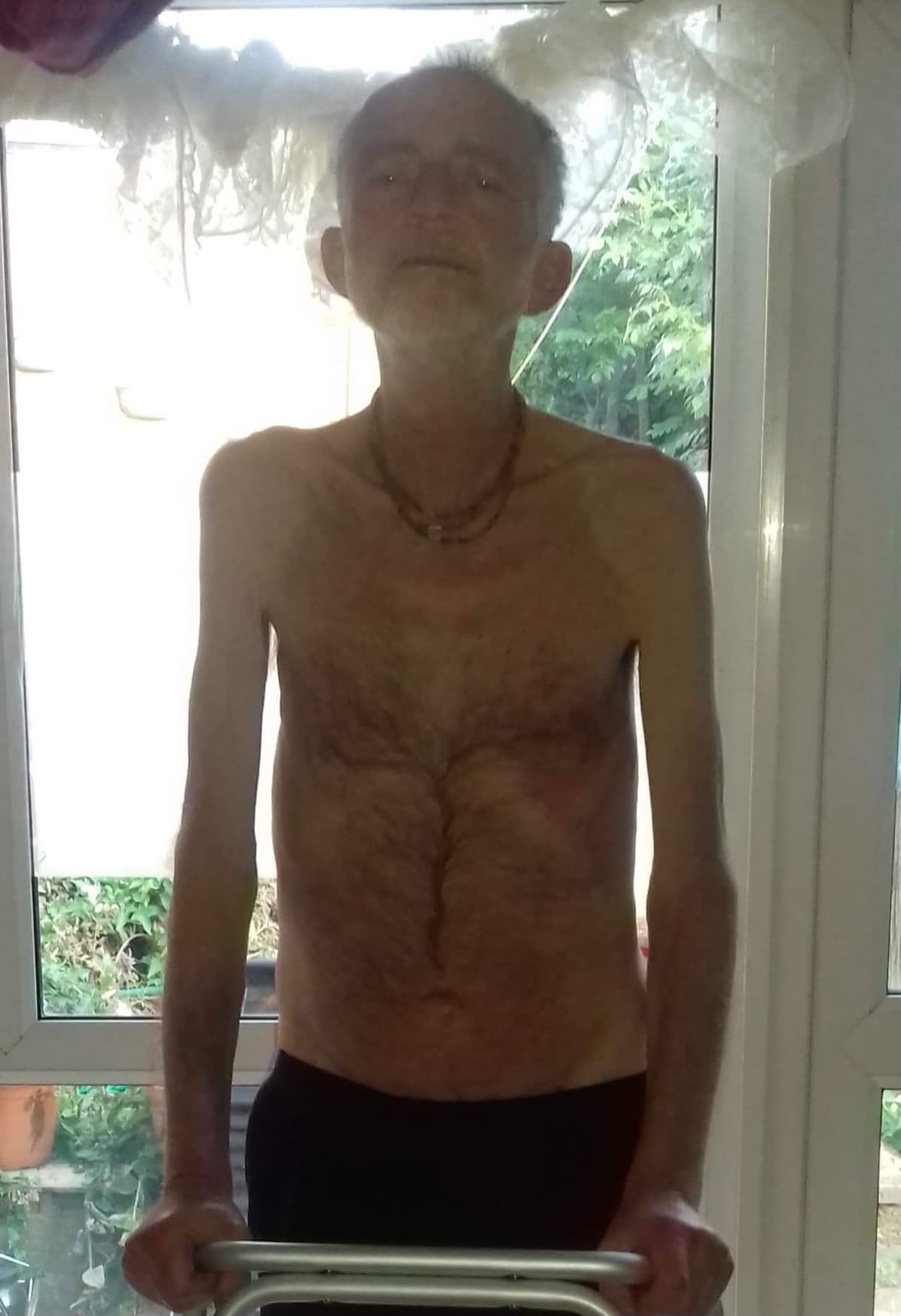 URGENTLIFESAVINGTREATMENT