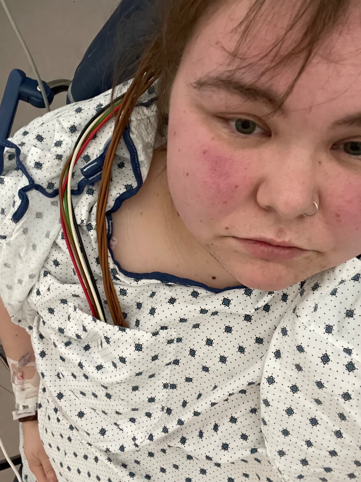 JordansChiariSurgery