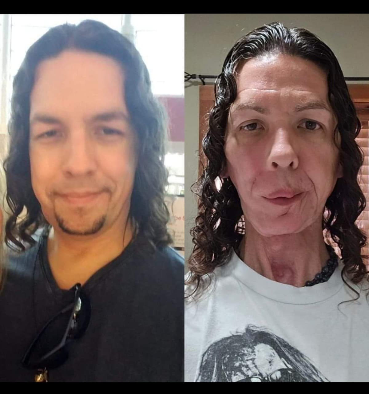 CancerInTheFace