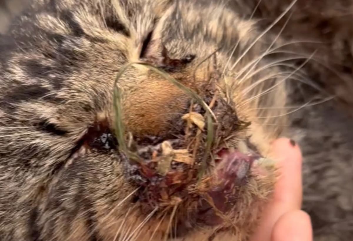 SurgeryForGordoBrokeJaw