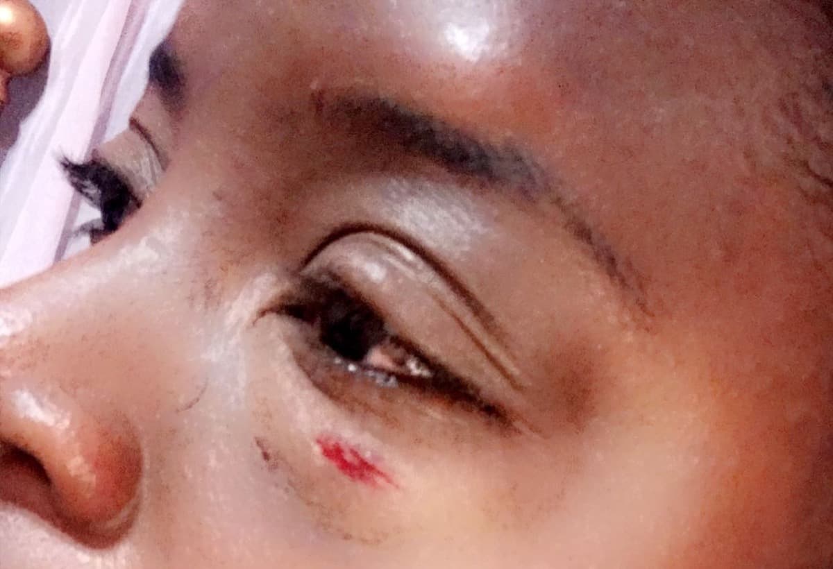 SurvivngDomesticAbuse