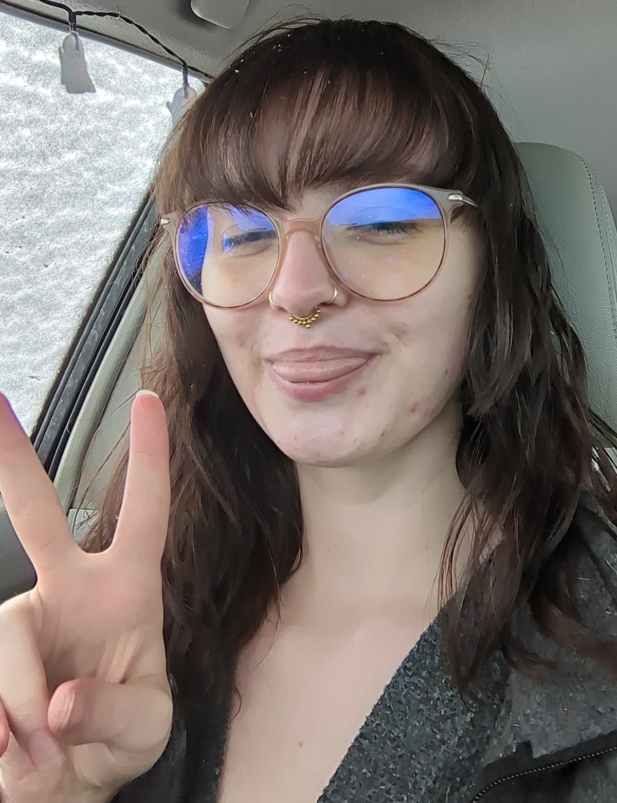 HelpRileyPayForSurgery