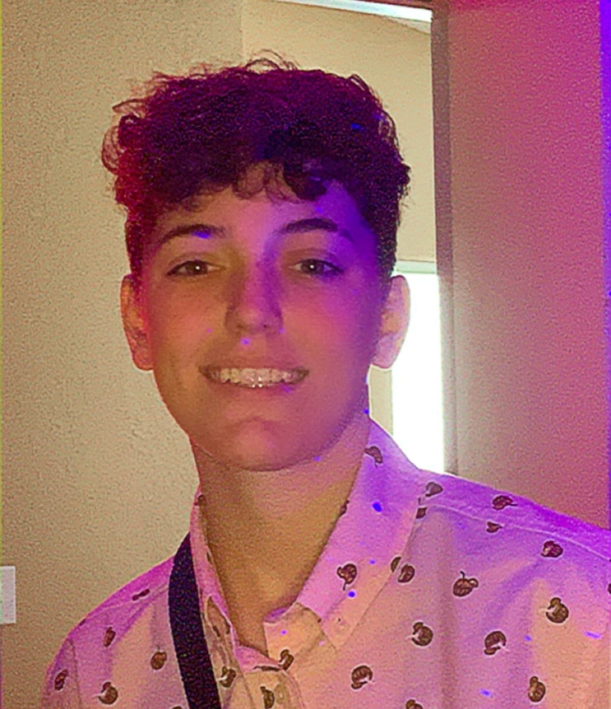 ShysTopSurgery