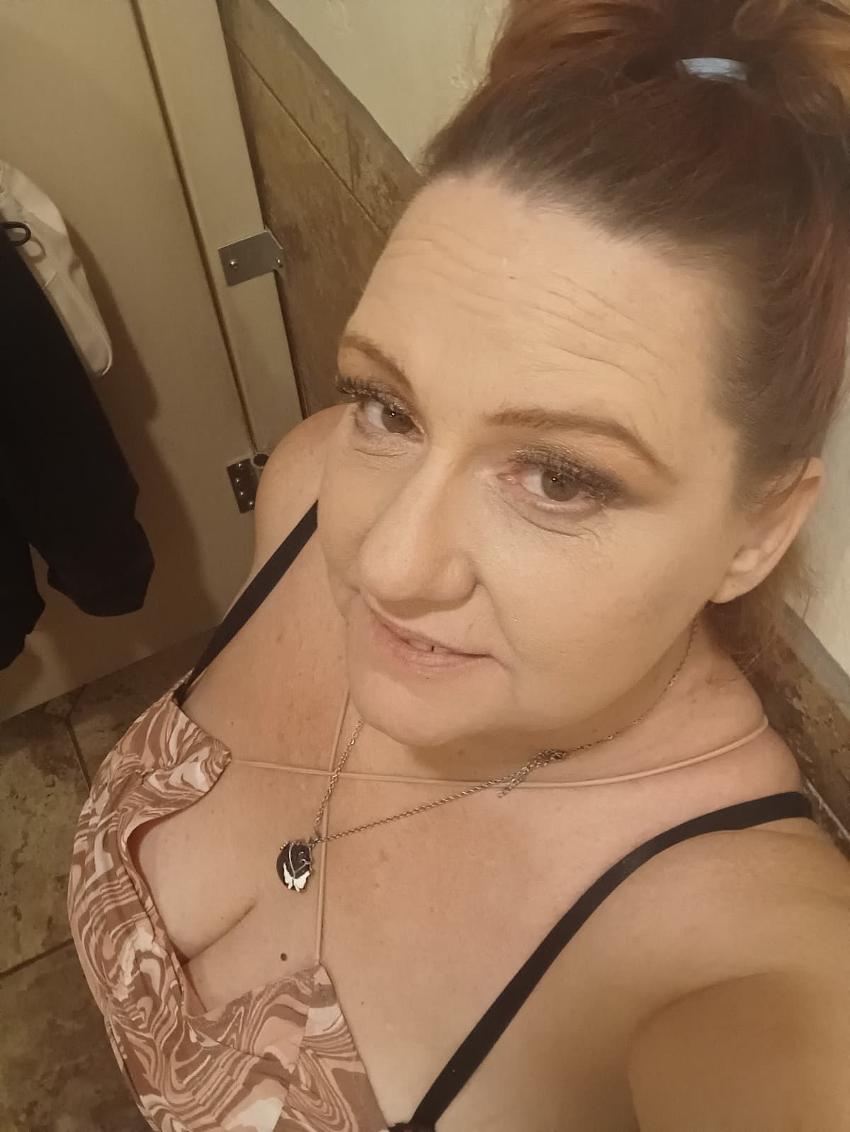 KidneyStoneNightmareHelp